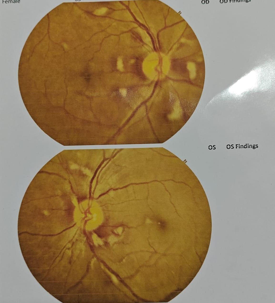 Patient Recovery Story